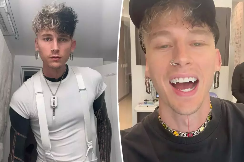 Machine Gun Kelly Reveals New Fangs and Tattoos on Instagram