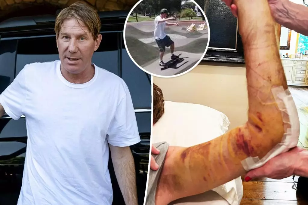 Family’s Unlucky Week: Skateboard Accident and Horse Fall