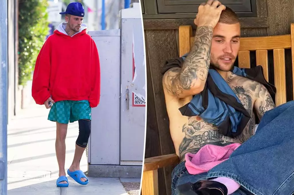 The Rising Concerns: Understanding Justin Bieber’s Ongoing Struggles
